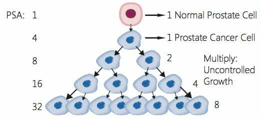 Cancer-Cell-Growth-Beginning-of-Prostate-Cancer