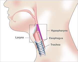 Hypopharynx-Diagram-Border
