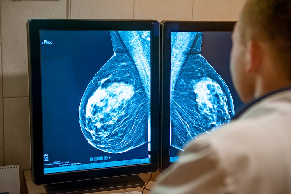 When is Radiation Therapy Used for Breast Cancer Treatment?